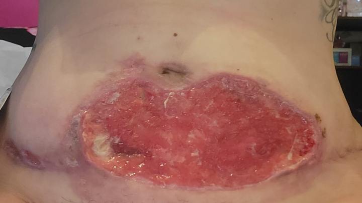 Main fundraiser photo