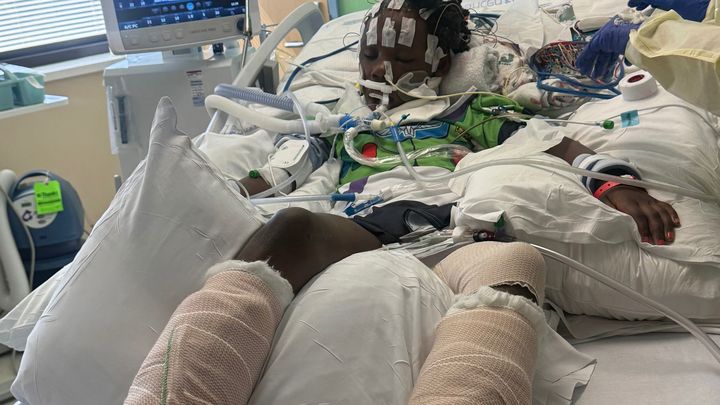 After a Devastating Hit and Run campaign photo, 1 of 8