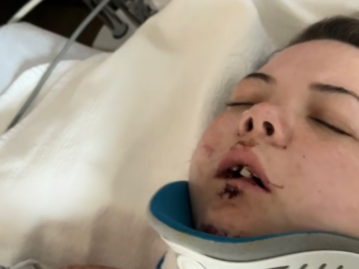 Help Kylie heal after her terrible accident campaign photo, 1 of 4