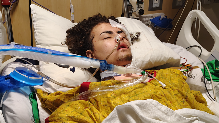 Support Giovanni's Long Road to Recovery campaign photo, 1 of 6