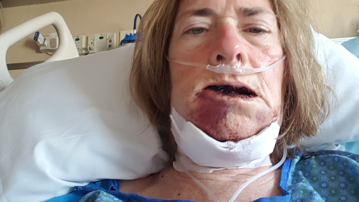 Support Mary’s Journey to Healing and Recovery campaign photo, 1 of 4