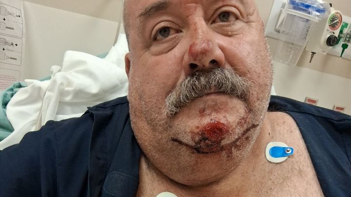 Support Volunteer Firefighter Jeff Crox’s Recovery campaign photo, 1 of 5