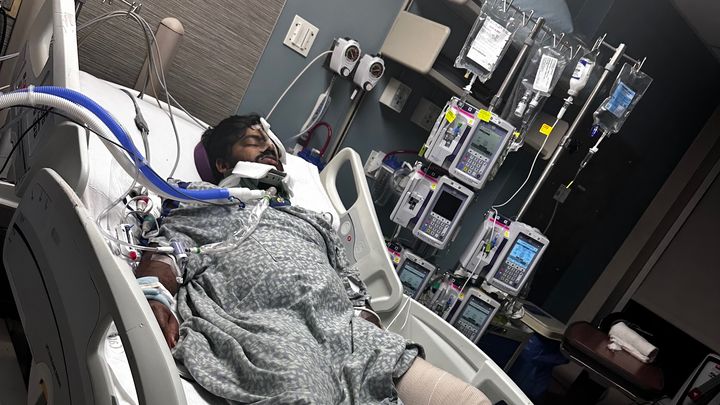 Help Saiteja Recover After Car Accident