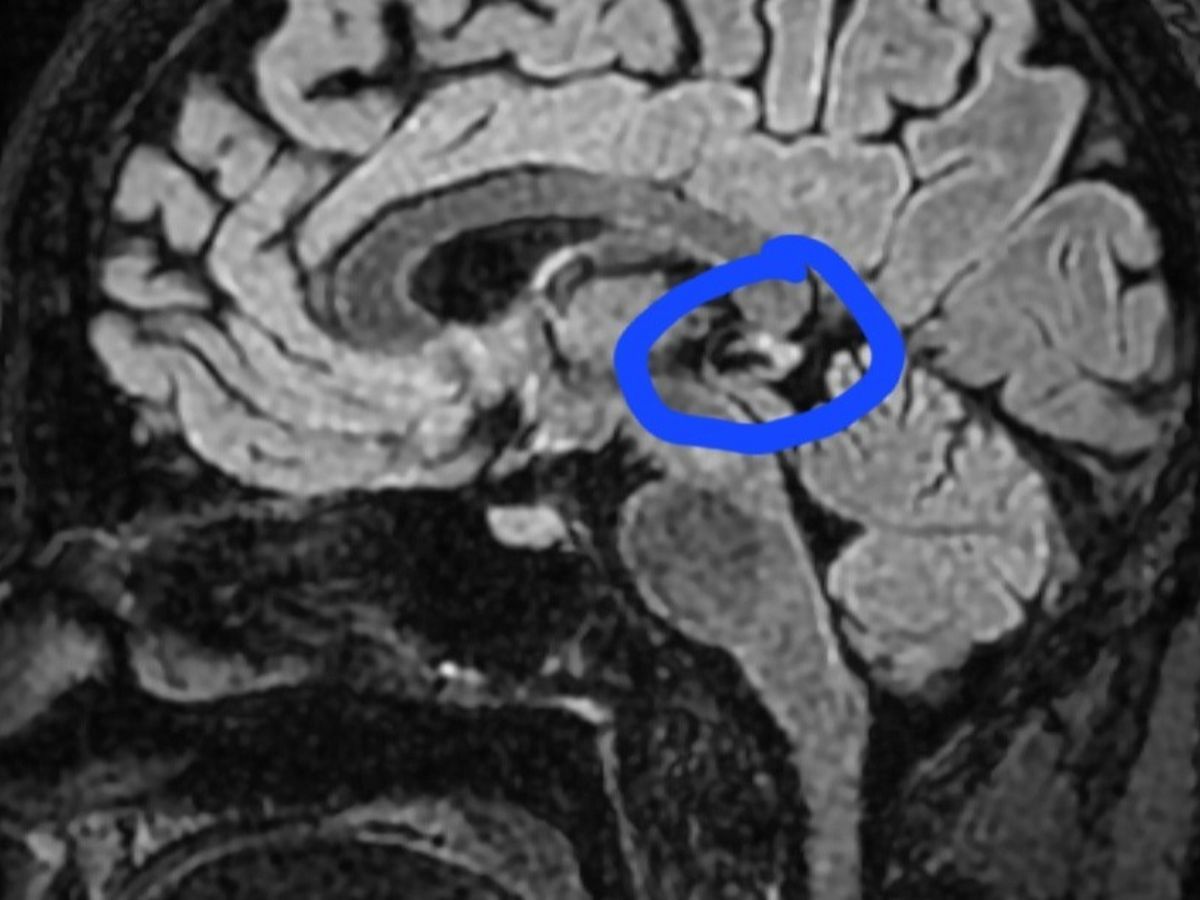 Fundraiser’s main image