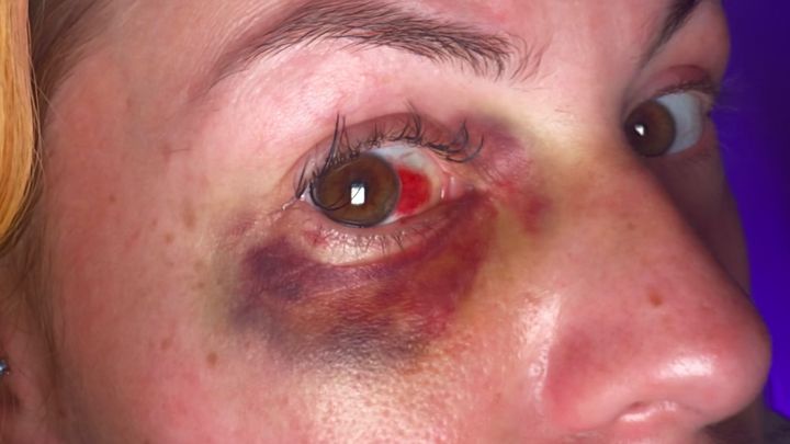 Help Pam Seek Justice on domestic violence and heal campaign photo, 1 of 8