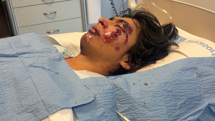 Support Brandon Mendez's Recovery campaign photo, 1 of 8