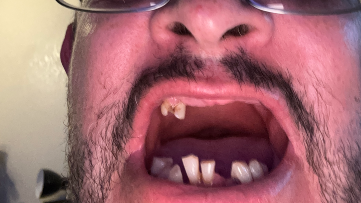 Support a Life-Changing Dental Transformation campaign photo, 1 of 3