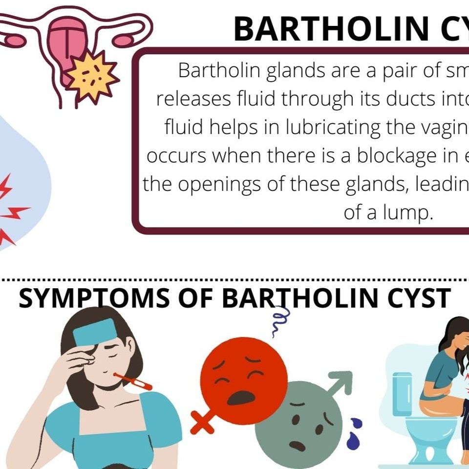 Pandian's homoeo care - The Bartholin's cyst (பார்தோலின்