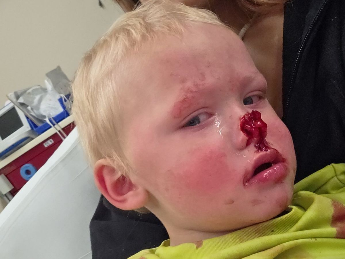 Fundraiser by Ashley Cunningham : Support Emmett’s Recovery After the ...