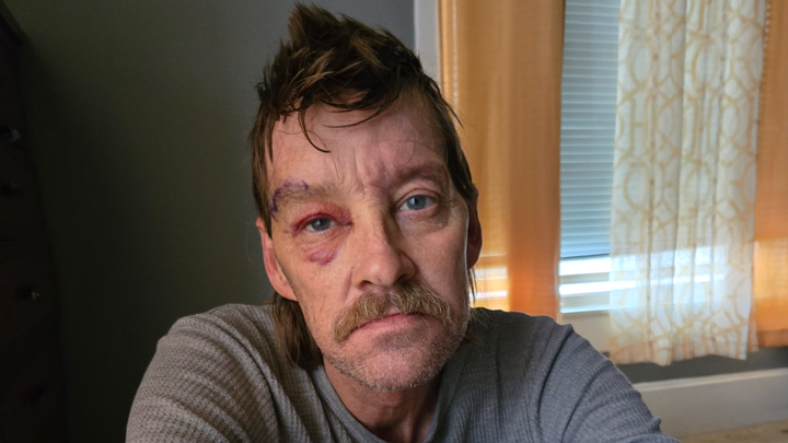 Support Carl's Fight Against Lung and Brain Cancer campaign photo, 1 of 3