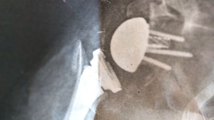 Foto principale della raccolta fondi