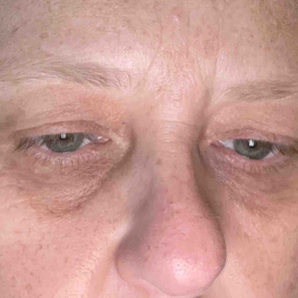 Support MS journey Medical bills,safe home