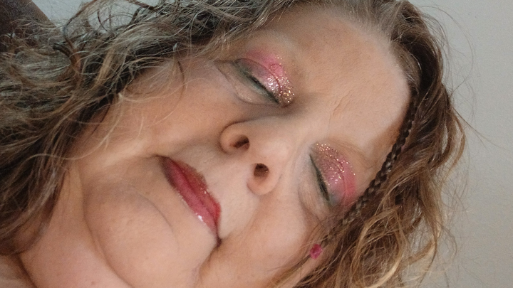 Belinda’s Journey to Life-Changing Surgeries campaign photo, 1 of 7