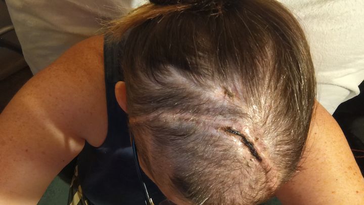 Support Shonna’s Brain Tumor Recovery campaign photo, 1 of 4